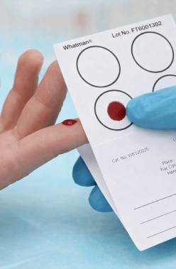 Tipos de Pruebas de VPH Disponibles